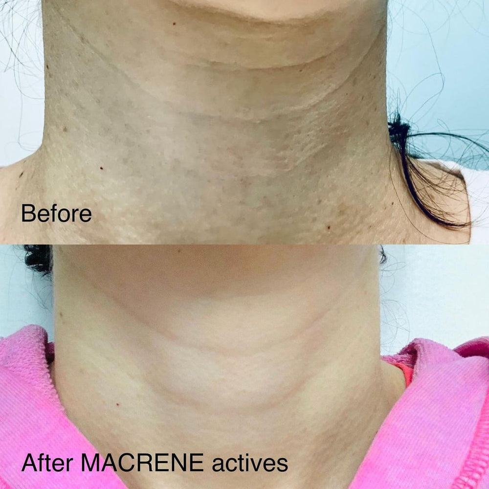 High Performance Neck and Décolletage Treatment
