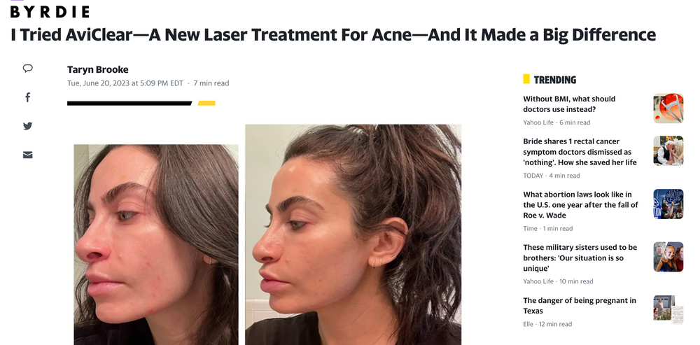 BYRDIE: I Tried AviClear—A New Laser Treatment For Acne—And It Made a Big Difference