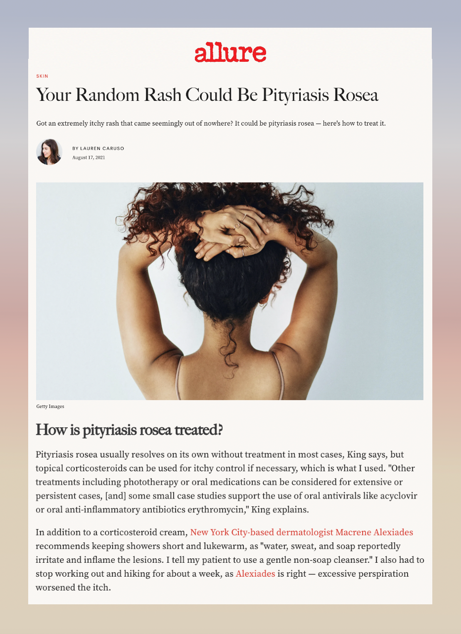 How to Treat Pityriasis Rosea