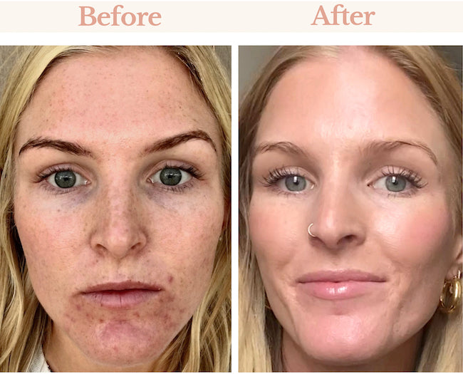 Amazing Before & After: High Performance Face Serum