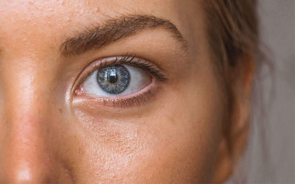 Skin Routine for Dark Undereye Circles