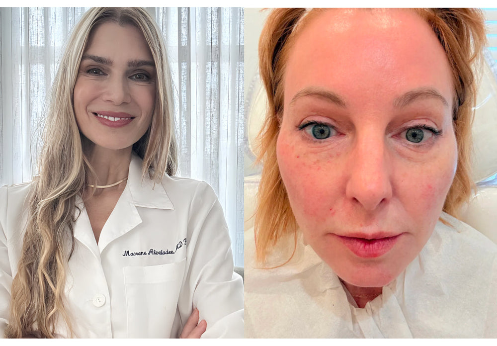 The Cut: "I Tried The Vampire Facial" With Dr. Macrene