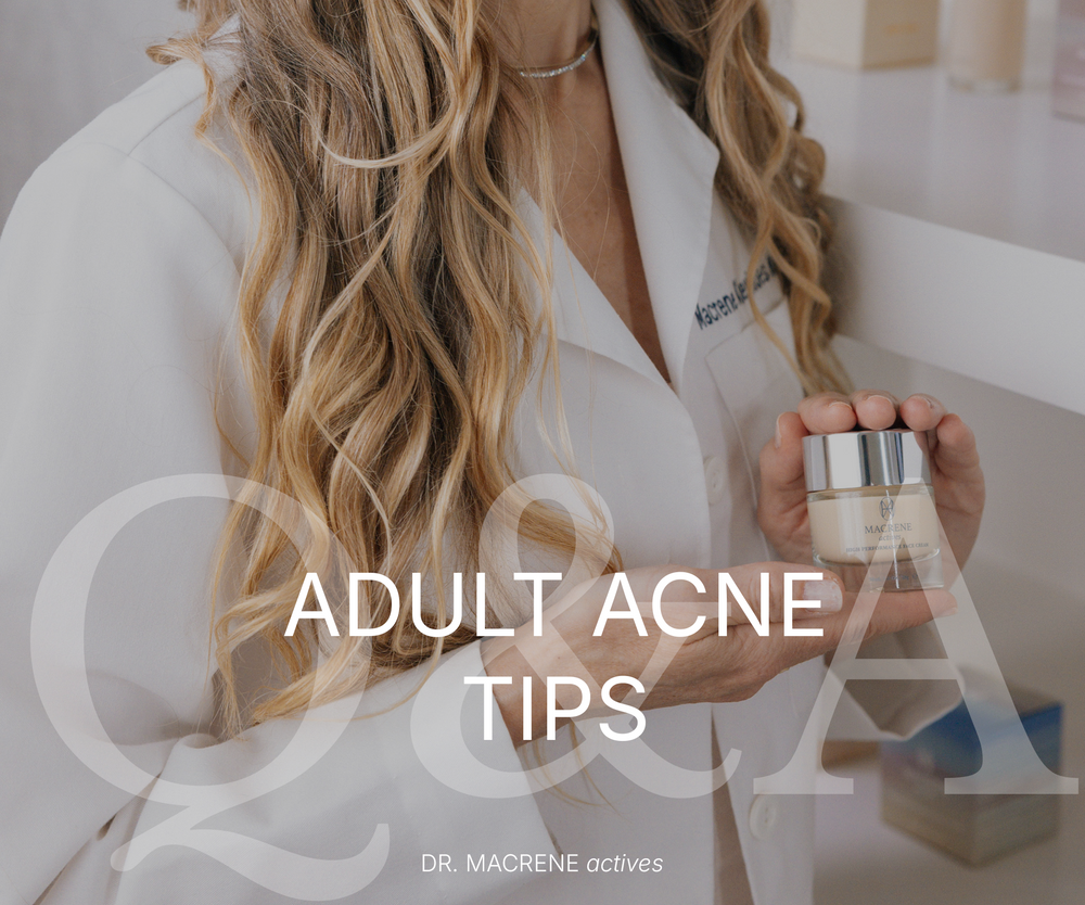 Ask Dr. Macrene: Combatting Adult Acne