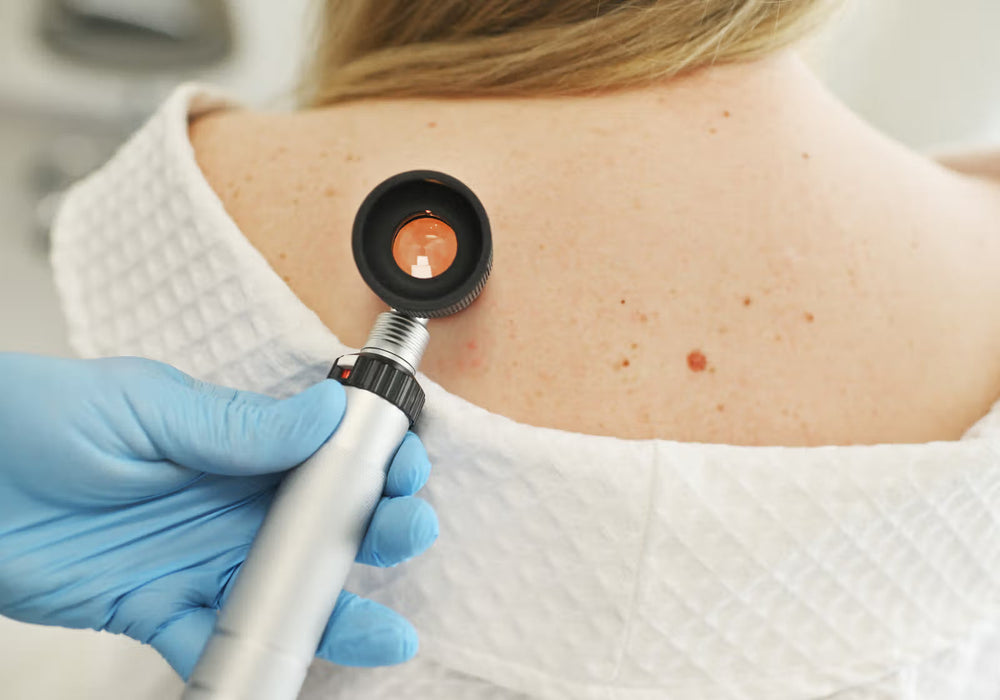 New Beauty: The Uncommon Signs of Skin Cancer Doctors Want You to Know with Dr. Macrene